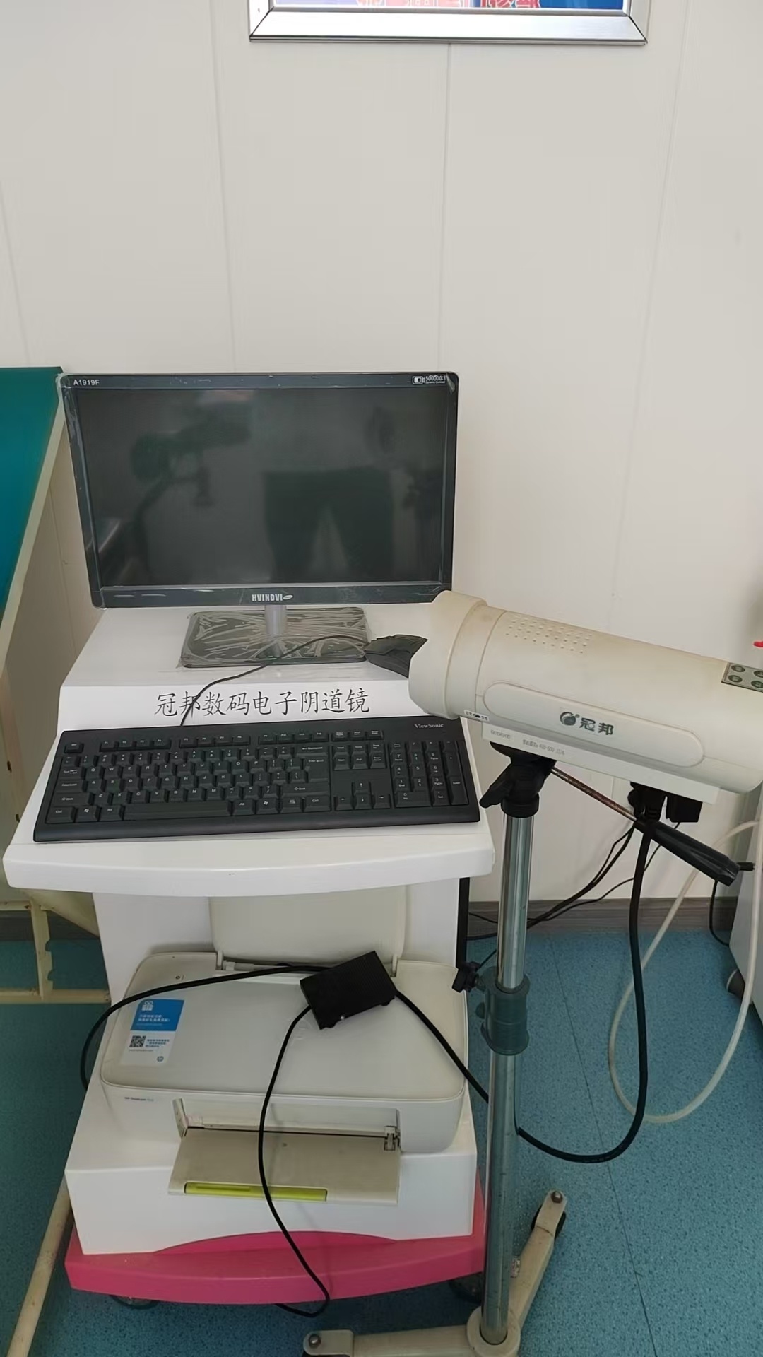 北京冠邦 数码电子阴道镜（200万像素）